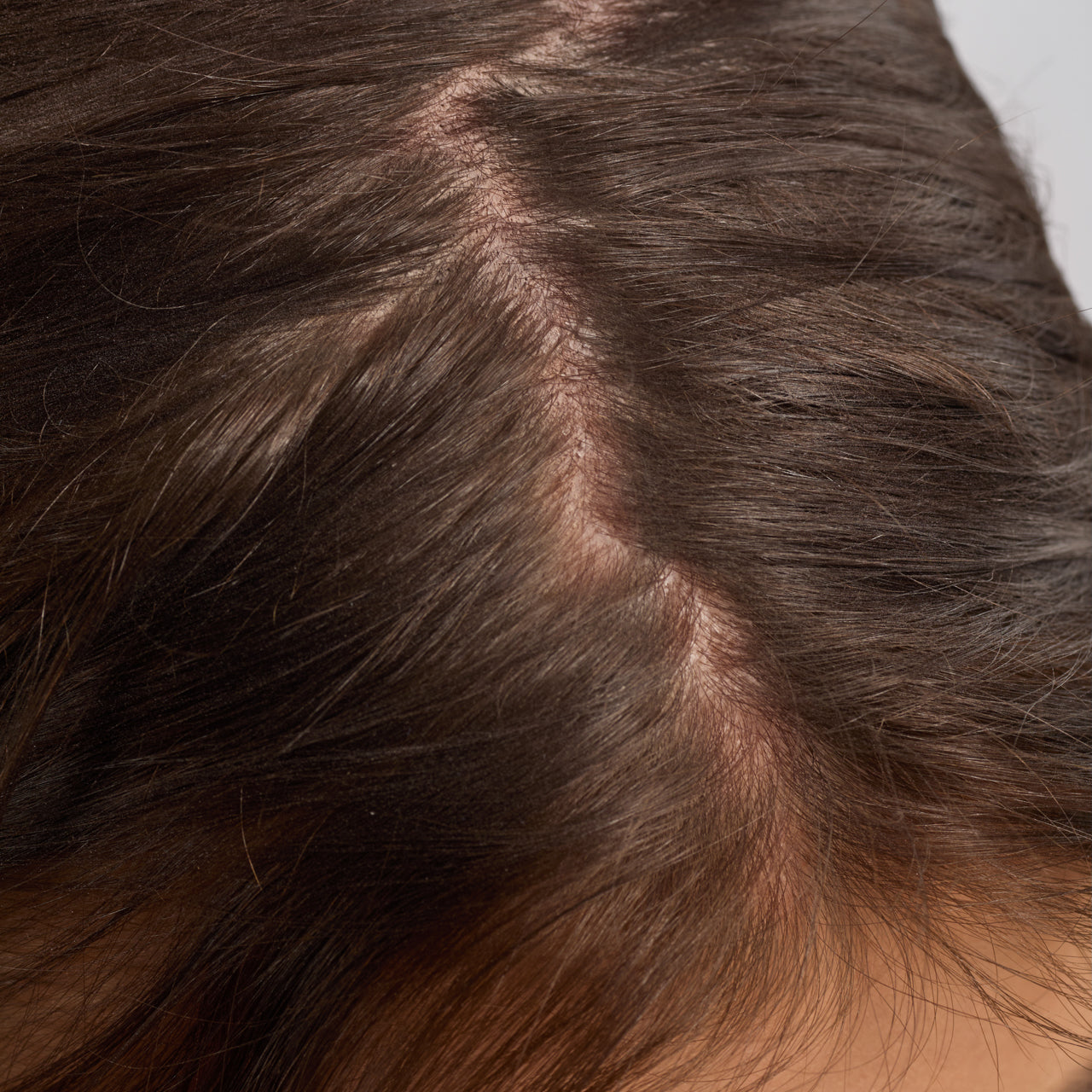 🔥 Hot Sale | Strengthening Rosemary & Biotin Scalp & Hair Oil - 2fl oz60mL - 60% Off - Image 5